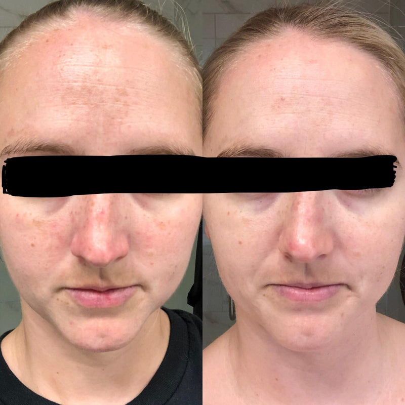 Real Results. Real Women.