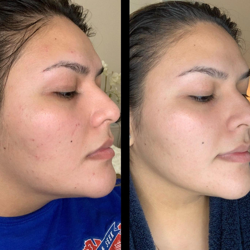 Real Results. Real Women.