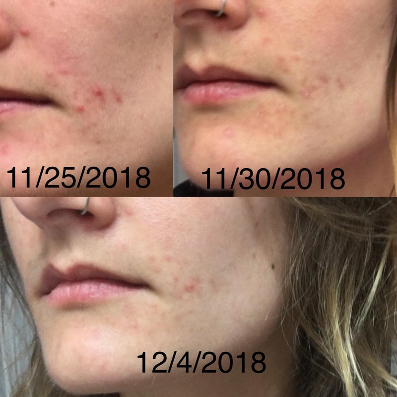 Real Results. Real Women.