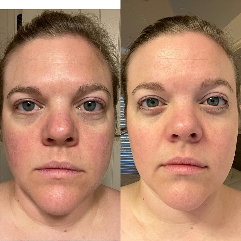 Real Results. Real Women.