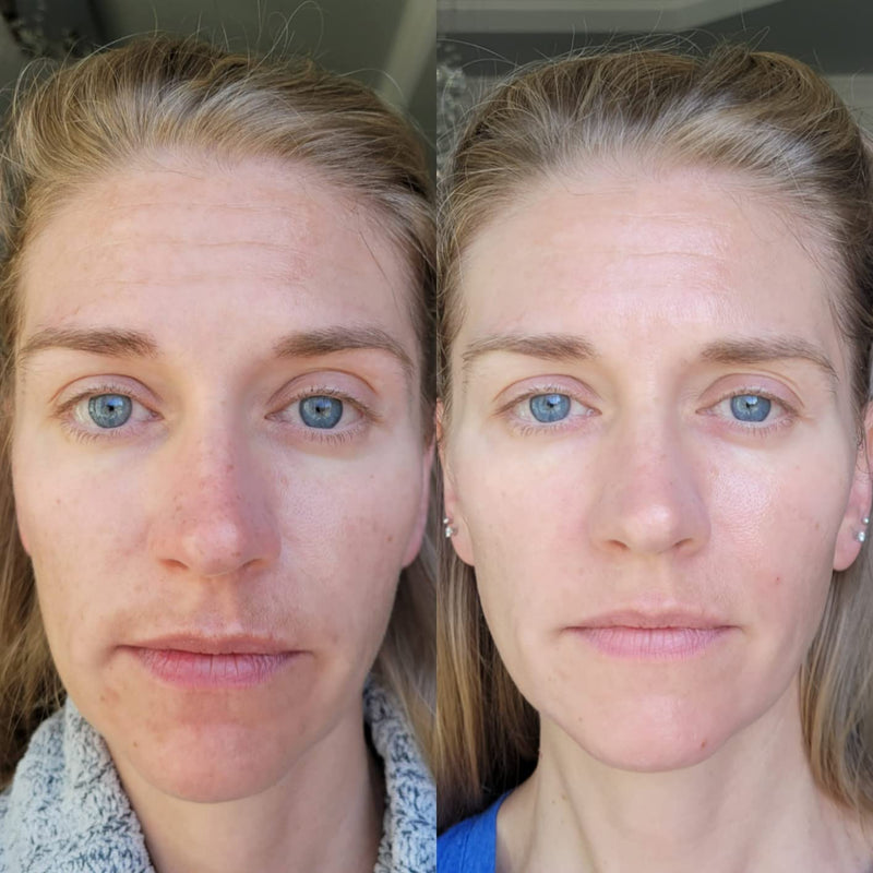 Real Results. Real Women.