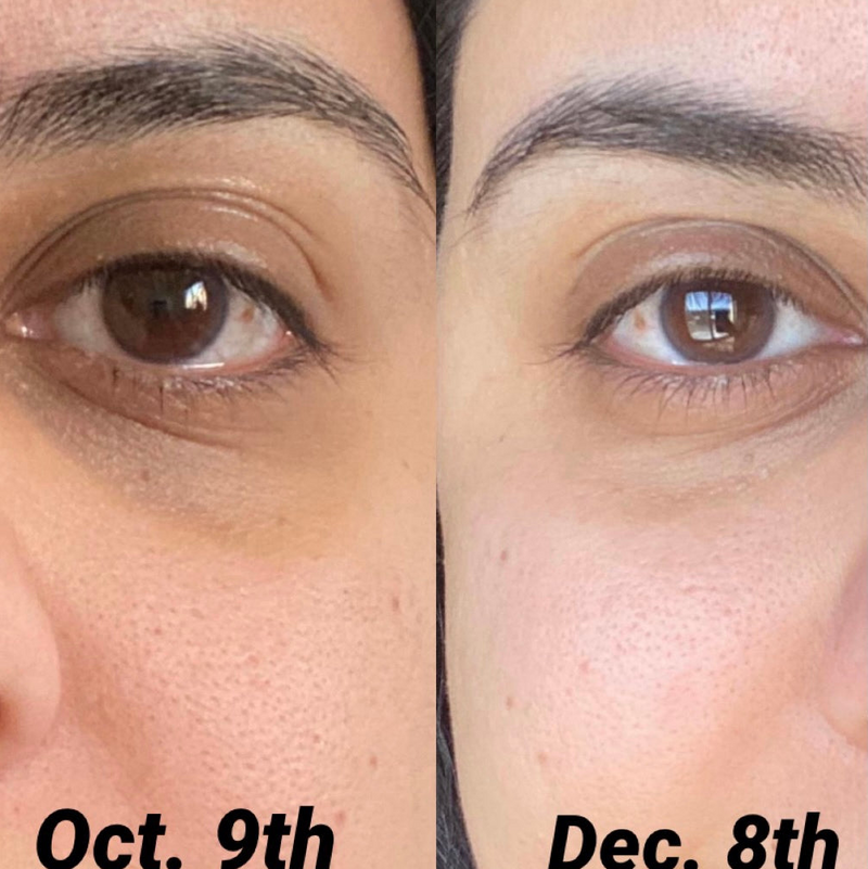 Real Results. Real Women.