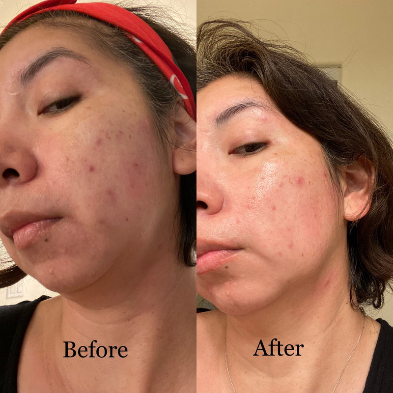 Real Results. Real Women.